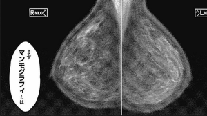 radiation_house01_04